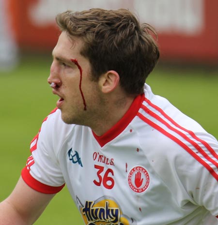 Scenes from the Ulster Football Championship quarter-finals between Donegal and Tyrone.